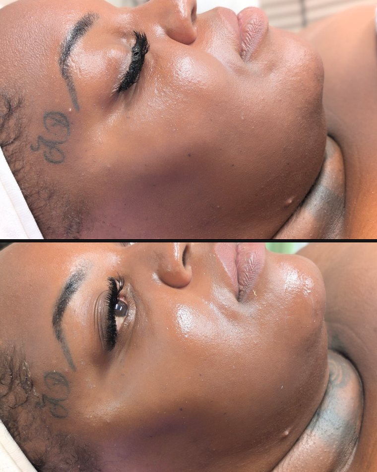 Before and after Detox and Rebuild
