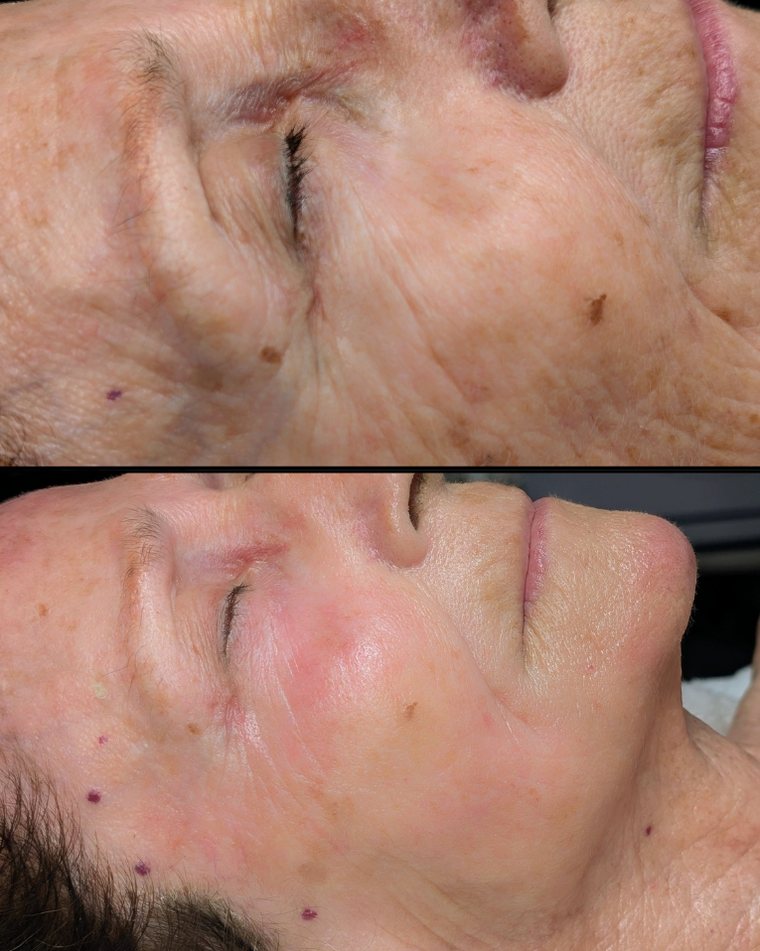 Before and after Detox and Rebuild