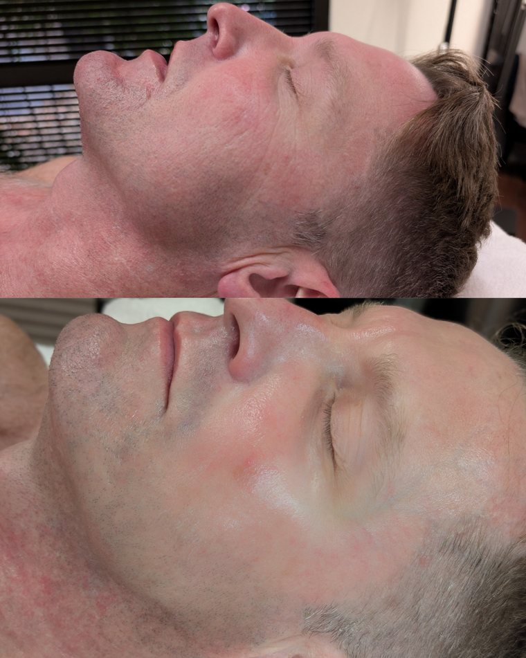 Before and after Detox and Rebuild