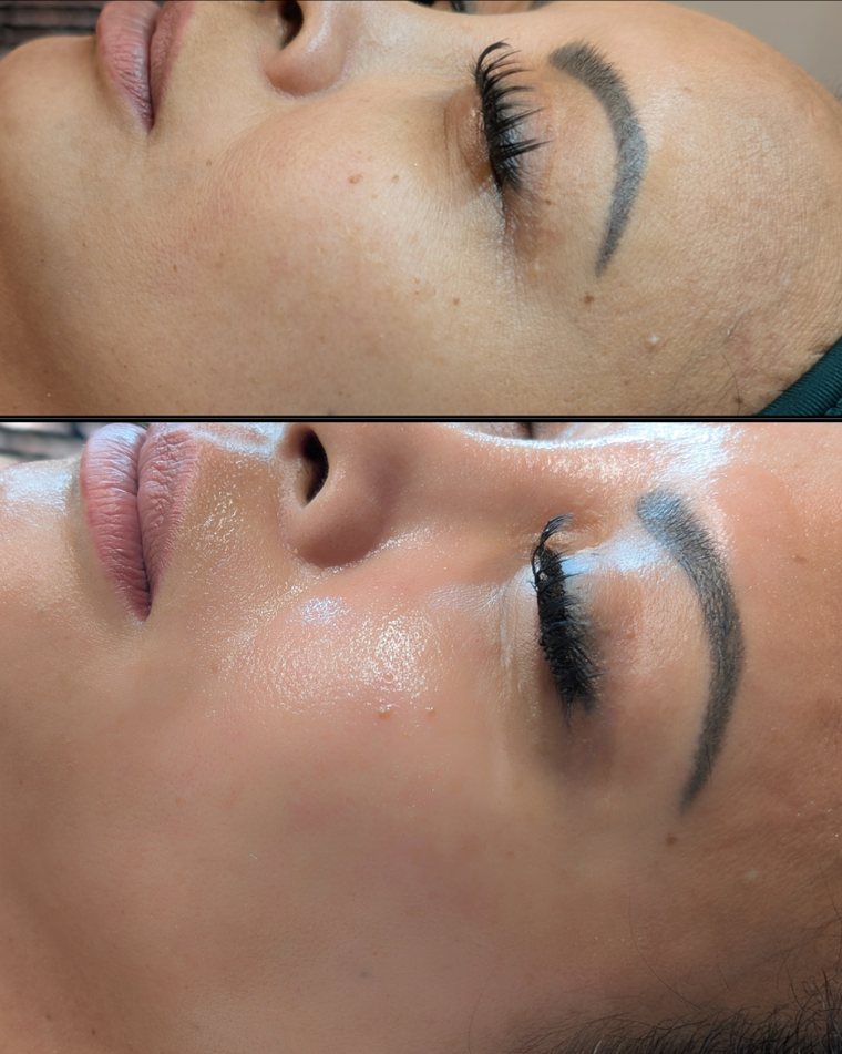Before and after Detox and Rebuild